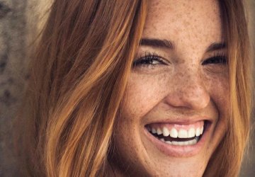 There are few natural ways to treat the freckles created by the sun. Read more how to do it without medical treatments.